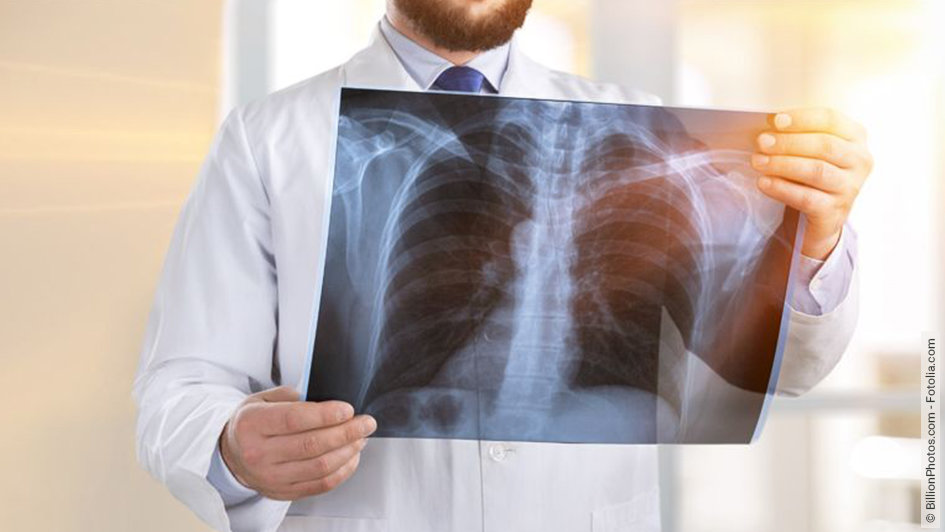 Chronische Bronchitis: Symptome & Behandlung | GeloMyrtol® forte