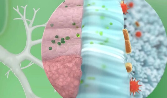 Der Wirkstoff von GeloMyrtol® forte bekämpft auf mehrfache Weise den Atemwegsinfekt und fördert den Heilungsprozess	