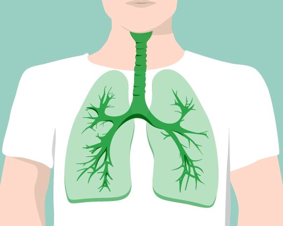 Bronchitis ist eine Entzündung der Schleimhaut in den Bronchien.