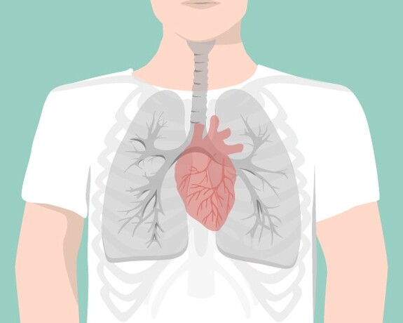 Eine Herzmuskelentzündung kann die Folge einer verschleppten Bronchitis sein.