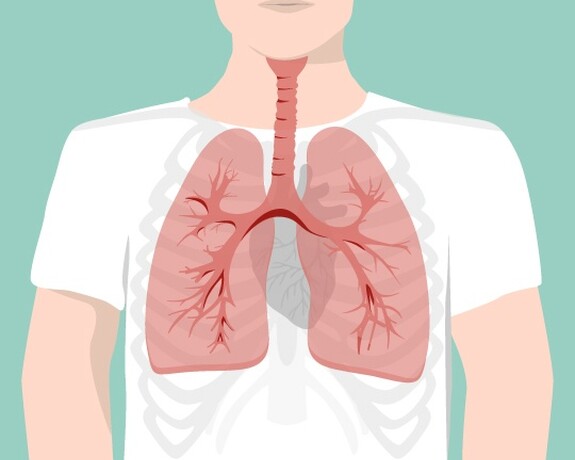 Eine verschleppte Bronchitis kann eine Lungenentzündung zur Folge haben.