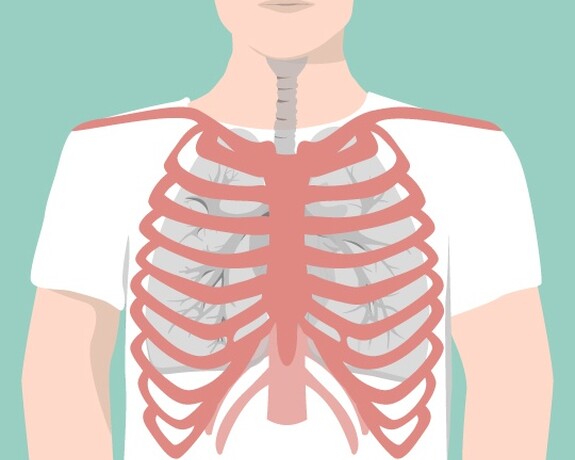 Durch eine verschleppte Bronchitis können Folgeerkrankungen, wie eine Rippenfellentzündung entstehen.